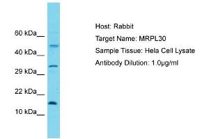 Host: Rabbit Target Name: MRPL30 Sample Tissue: Human Hela Whole Cell Antibody Dilution: 1ug/ml (MRPL30 antibody  (C-Term))