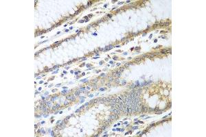 Immunohistochemistry (Paraffin-embedded Sections) (IHC (p)) image for anti-Protein Disulfide Isomerase Family A, Member 3 (PDIA3) (AA 206-505) antibody (ABIN3021400)