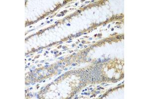 Immunohistochemistry of paraffin-embedded human stomach using PDIA3 antibody. (PDIA3 antibody  (AA 206-505))