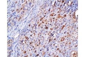 Immunohistochemistry (Paraffin-embedded Sections) (IHC (p)) image for anti-Cyclin-Dependent Kinase 2 (CDK2) (AA 1-100) antibody (ABIN2172819)