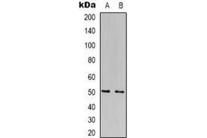 Western blot analysis of FOXN4 expression in Jurkat (A), HepG2 (B) whole cell lysates. (FOXN4 antibody  (C-Term))