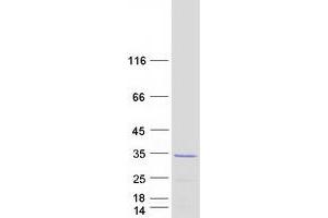 Validation with Western Blot