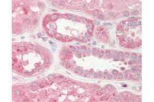 Human Kidney: Formalin-Fixed, Paraffin-Embedded (FFPE) (Stim2 antibody  (N-Term))