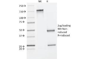 SDS-PAGE Analysis Purified Cytokeratin 8 Mouse Monoclonal Antibody (C-43). (KRT8 antibody)