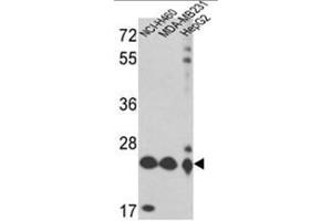 Western blot analysis of PRDX3 Antibody (Peroxiredoxin 3 antibody  (N-Term))