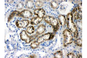 Anti- Prealbumin Picoband antibody,IHC(P) IHC(P): Rat Kidney Tissue (TTR antibody  (AA 21-147))