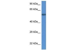 Human MDA-MB435; WB Suggested Anti-GBA Antibody Titration: 1 ug/ml. (GBA antibody  (C-Term))