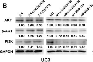 ZNF139 and its circRNA (circZNF139) activates PI3K/AKT signaling pathway in BC cells. (GAPDH antibody)