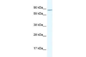 WB Suggested Anti-AHR Antibody Titration:  2. (Aryl Hydrocarbon Receptor antibody  (N-Term))