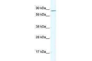 WB Suggested Anti-AHR Antibody Titration:  2.