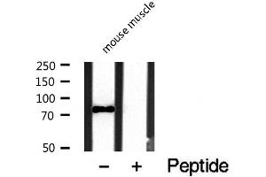 Western blot analysis of PDE4C expression in mouse brain lysate (PDE4C antibody  (Internal Region))