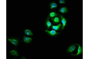 Immunofluorescence staining of A549 cells with ABIN7162334 at 1:100, counter-stained with DAPI. (OTUD5 antibody  (AA 51-183))