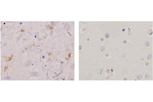 Immunohistochemistry analysis of human brain tissue slide (Paraffin embedded) using Rabbit Anti-Glutamine Synthetase Polyclonal Antibody (Left, ABIN398821) and Purified Rabbit IgG (Whole molecule) Control (Right, ABIN398653) (GLN1 antibody  (AA 300-350))