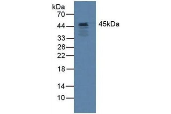 SERPINB3 抗体  (AA 1-210)