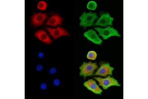 ABIN6263420 and ABIN6273269 staining HepG2 cells by IF/ICC.