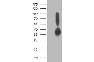 Western Blotting (WB) image for anti-Aldolase B, Fructose-Bisphosphate (ALDOB) antibody (ABIN1496608) (ALDOB antibody)
