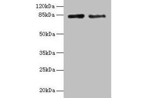 Western blot All lanes: HJURP antibody at 12 μg/mL Lane 1: Jurkat whole cell lysate Lane 2: Hela whole cell lysate Secondary Goat polyclonal to rabbit IgG at 1/10000 dilution Predicted band size: 84, 78, 75 kDa Observed band size: 84 kDa (HJURP antibody  (AA 1-748))
