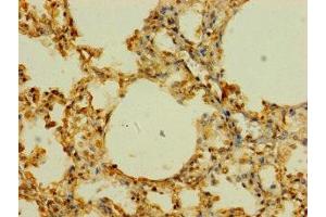 Immunohistochemistry of paraffin-embedded human lung tissue using ABIN7170255 at dilution of 1:100 (SLC43A3 antibody  (AA 209-278))