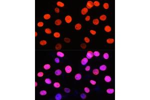 Immunofluorescence analysis of NIH-3T3 cells using Symmetric DiMethyl-Histone H3-R2 Rabbit pAb (ABIN3016053, ABIN3016054, ABIN3016055, ABIN1680220 and ABIN6219534) at dilution of 1:100 (40x lens). (Histone 3 antibody  (H3R2me2))