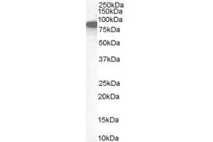 ABIN185664 (1µg/ml) staining of Human Placenta lysate (35µg protein in RIPA buffer). (Ezrin antibody  (Internal Region))