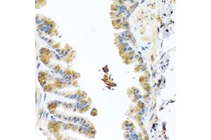 Immunohistochemistry of paraffin-embedded mouse lung using CHI3L2 antibody at dilution of 1:100 (40x lens). (CHI3L2 antibody)