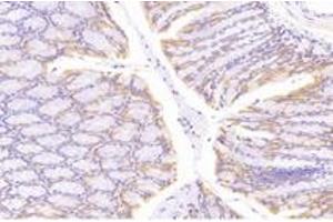 Immunohistochemistry analysis of paraffin-embedded mouse colon using,NT5C1B (ABIN7072861) at dilution of 1: 1200 (NT5C1B antibody)