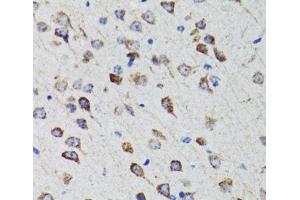 Immunohistochemistry of paraffin-embedded Rat brain using HEXA Polyclonal Antibody at dilution of 1:100 (40x lens). (Hexosaminidase A antibody)