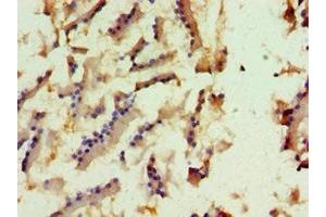 Immunohistochemistry of paraffin-embedded human prostate tissue using ABIN7157655 at dilution of 1:100 (KIF6 antibody  (AA 565-814))