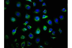 Immunofluorescence staining of A549 cells with ABIN7154582 at 1:66, counter-stained with DAPI. (DIRAS1 antibody  (AA 1-195))