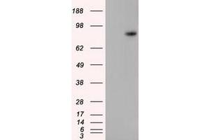 HEK293T cells were transfected with the pCMV6-ENTRY control (Left lane) or pCMV6-ENTRY H6PD (Right lane) cDNA for 48 hrs and lysed. (Glucose-6-Phosphate Dehydrogenase antibody)