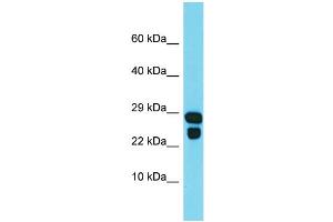 Western Blotting (WB) image for anti-IdnK Gluconokinase Homolog (IDNK) (Middle Region) antibody (ABIN2790936) (IdnK antibody  (Middle Region))