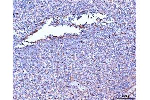 IHC analysis of Filamin B/FLNB using anti-Filamin B/FLNB antibody (ABIN7601606). (FLNB antibody  (AA 397-701))