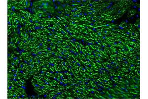 Image no. 3 for anti-Cardiotin antibody (ABIN335361) (Cardiotin antibody)