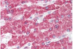 Human Liver (formalin-fixed, paraffin-embedded) stained with GCLC antibody ABIN337056 at 5 ug/ml followed by biotinylated goat anti-rabbit IgG secondary antibody ABIN481713, alkaline phosphatase-streptavidin and chromogen. (GCLC antibody  (AA 295-313))