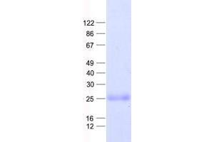Western Blotting (WB) image for Transmembrane Protein 18 (TMM18) protein (His tag) (ABIN2733881)