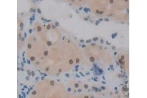 Figure. (RAD50 antibody  (AA 400-595))