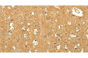 Immunohistochemistry of paraffin-embedded Human brain tissue using EDG7 Polyclonal Antibody at dilution 1:40 (LPAR3 antibody)