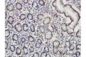 Immunoperoxidase of monoclonal antibody to ROD1 on formalin-fixed paraffin-embedded human small Intestine. (PTBP3 antibody  (AA 16-114))