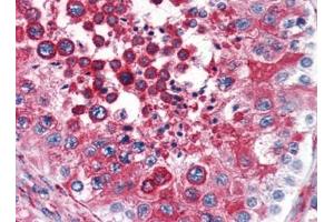 Image no. 1 for anti-Reticulon 4 (RTN4) (N-Term) antibody (ABIN372912) (Reticulon 4 antibody  (N-Term))