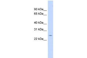 WB Suggested Anti-CRP Antibody Titration:  0.