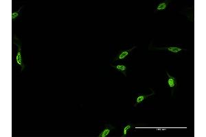 Immunofluorescence of monoclonal antibody to CPSF6 on HeLa cell. (CPSF6 antibody  (AA 37-136))
