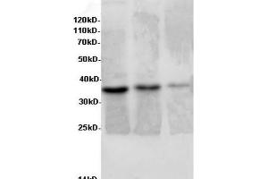 Western Blot analysis of Rat liver, Rat lung tissue and Jurkat cells using AIMP2 Polyclonal Antibody at dilution of 1:600 (AIMP2 antibody)