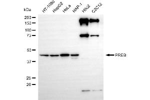 Western blotting analysis using PREB antibody (ABIN7799913). (Recombinant PREB antibody)