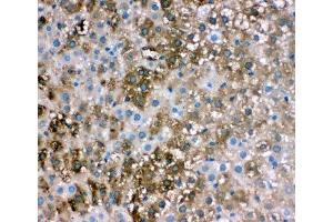 IHC-P: FABP1 antibody testing of rat liver tissue (FABP1 (liver) antibody  (N-Term))