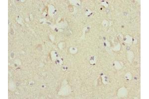 Immunohistochemistry of paraffin-embedded human brain tissue using ABIN7159842 at dilution of 1:100 (MTCH1 antibody  (AA 100-250))