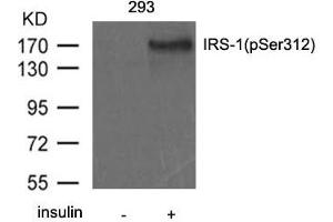 Western blot analysis of extract from 293 cells untreated or treated with insulin using IRS-1(Phospho-Ser312) antibody. (IRS1 antibody  (pSer312))