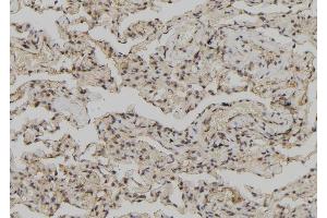 ABIN6278135 at 1/100 staining Human lung tissue by IHC-P. (Annexin IV antibody  (Internal Region))