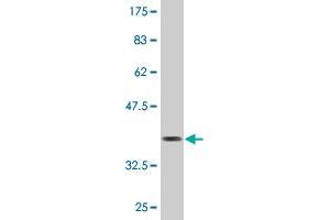 Western Blot detection against Immunogen (37. (Desmin antibody  (AA 361-470))