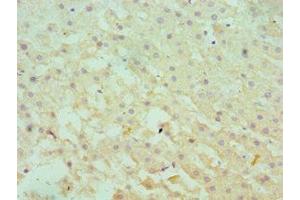 Immunohistochemistry of paraffin-embedded human liver tissue using ABIN7166366 at dilution of 1:100 (SERPINA1 antibody  (AA 165-444))