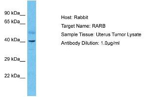 Host: Rabbit Target Name: RARB Sample Type: Uterus Tumor lysates Antibody Dilution: 1. (Retinoic Acid Receptor beta antibody  (N-Term))